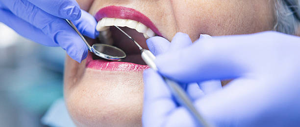 Best Emergency Dentist for Knocked-Out Tooth in White Island Shores, MA